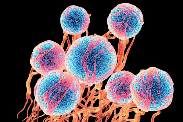 De ce Millennials se confruntă cu un risc mai mare de cancer decât părinții lor – și cum îl pot reduce