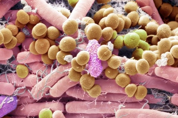 Cum Ciupercile din Interiorul Tău Pot Afecta Sănătatea