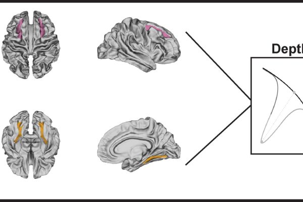 Caracteristici distincte ale creierului la jucătorii de fotbal care ar putea indica riscul de boală traumatică pe termen lung