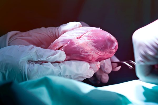 Mitul Organelor Transplantate care Pot Conferi Tineret Etern: Ce Spune Știința.