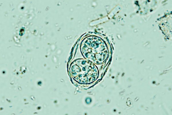 Descoperirea Butonului de Oprire ar putea ajuta la curățarea creierelor noastre de un parazit comun