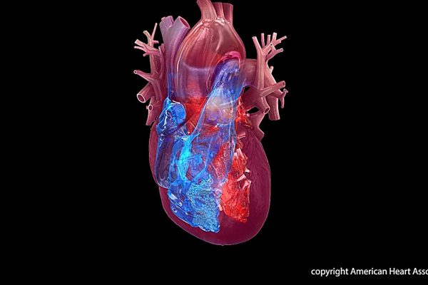 Noua inițiativă pentru susținerea diagnosticării și tratamentului timpuriu al stenozei aortice