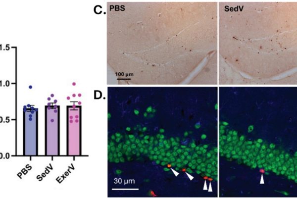 Cum vesiculele induse de exerciții fizice stimulează creșterea neuronilor când sunt transplantate în șoareci sedentari