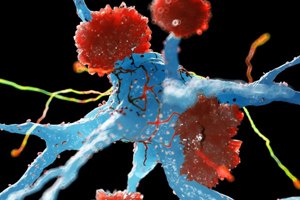 Descoperire: Celulele imune din creier devin protecția împotriva Alzheimer-ului