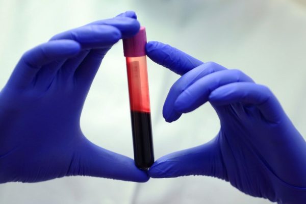 Sângele Persoanelor cu Longevitate Excepțională Dezvăluie Diferențe Cruciale