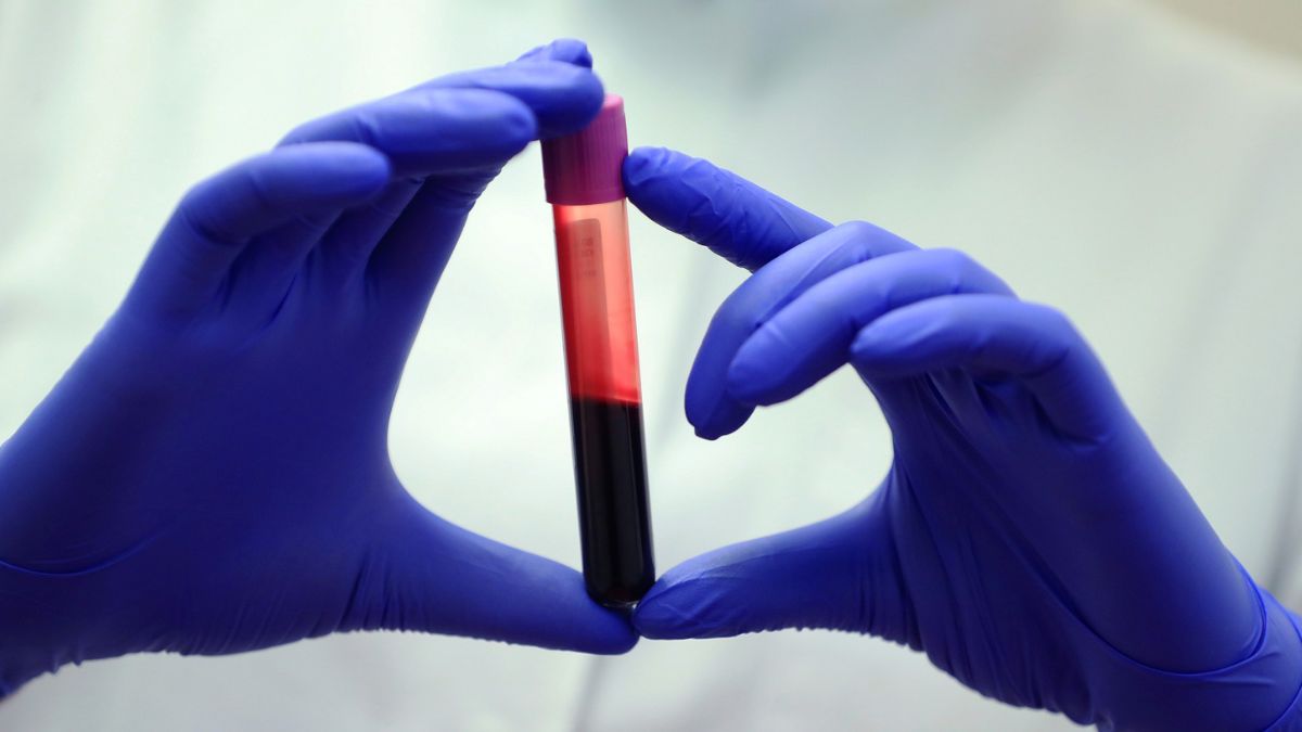 Sângele Persoanelor cu Longevitate Excepțională Dezvăluie Diferențe Cruciale