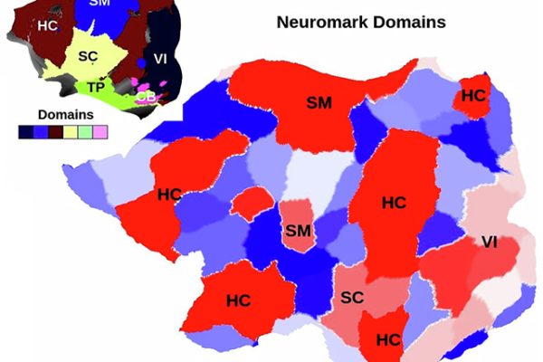 Descoperirea „cutremurului cerebral” ar putea schimba ceea ce știm despre schizofrenie