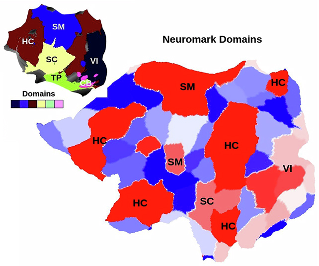 Descoperirea „cutremurului cerebral” ar putea schimba ceea ce știm despre schizofrenie