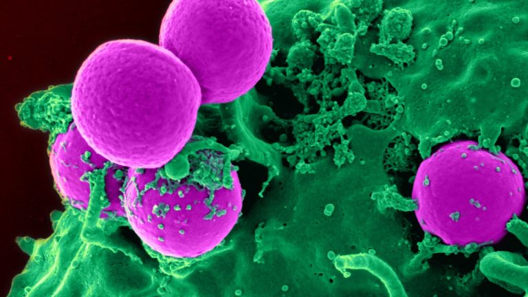 Descoperiri îngrijorătoare privind viitoarea rezistență antimicrobiană găsite în apele uzate
