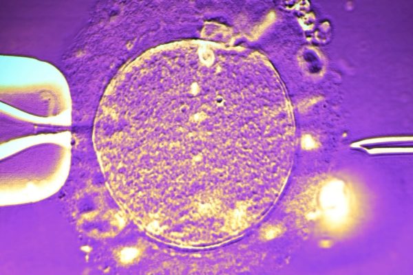 Donator de Spermă cu Genă Rare de Risc pentru Cancer, Tatăl a Aproape 200 de Copii