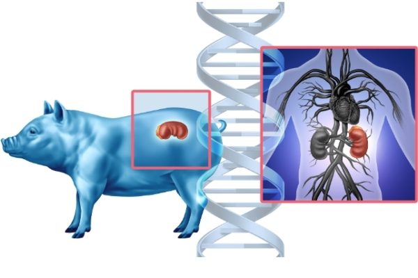 Trasplanturile de Organe de Porc, o Paradoxală Provocare Etică, susține un Eticist