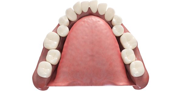 Istoria Apariției Aparatelor Dentare nu este atât de Antică pe cât Credeam
