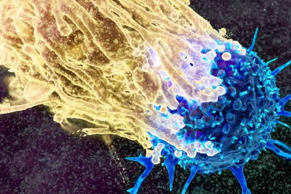 Cum vor cercetătorii să intercepteze cancerul cu decenii înainte să se dezvolte. Iată cum.