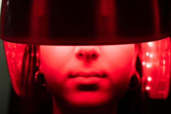 Noua Terapie cu Lumină Poate Suprima un Indicator Cheie al Căderii Părului cu 92%