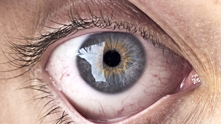 Bacteriile din spatele ochiului tău ar putea fi legate de progresul în Alzheimer