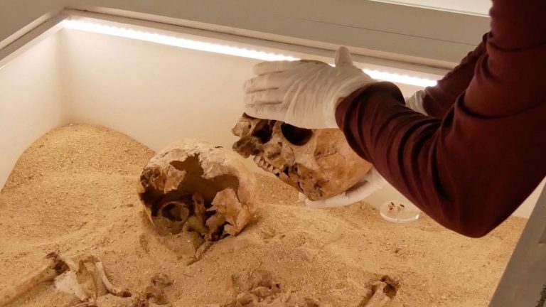 Descoperirea unei Boli Genetice Rare într-o Îmbrățișare Osoasă Antică din Epoca de Gheață