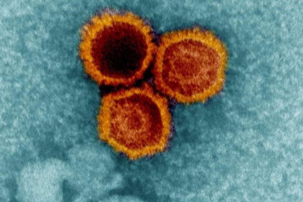 Cercetătorii descoperă dovezi noi că un virus comun ajută la declanșarea sclerozei multiple