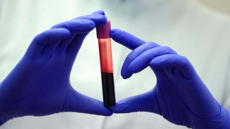 Impactul Creșterii CO2 asupra Chimiei Sângelui Nostru, Conform unui Studiu