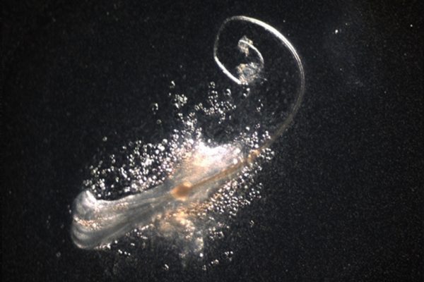 Cercetătorii au Crescut pentru Prima Dată Folliculi Pilosi Complet Funcționali în Laborator