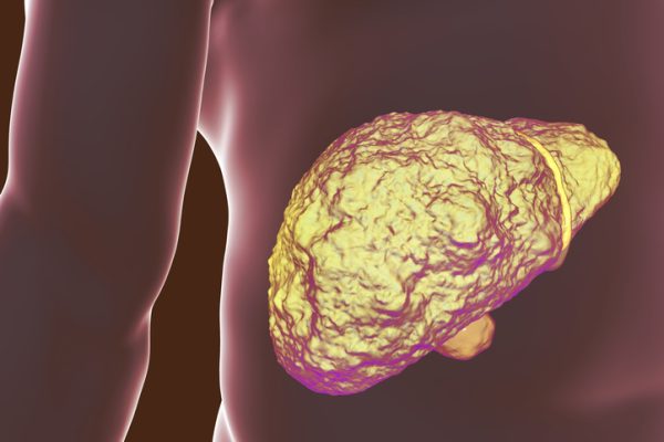 Terapia celulară promite tratamentul bolilor hepatice avansate