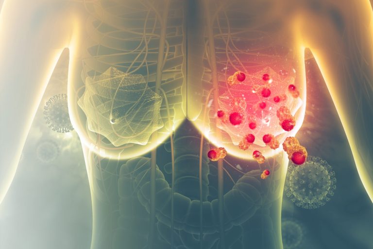 Un Nou Medicament pentru Prevenirea Cancerului de Sân, Endoxifen, Arată Promisiuni la Doze Scăzute