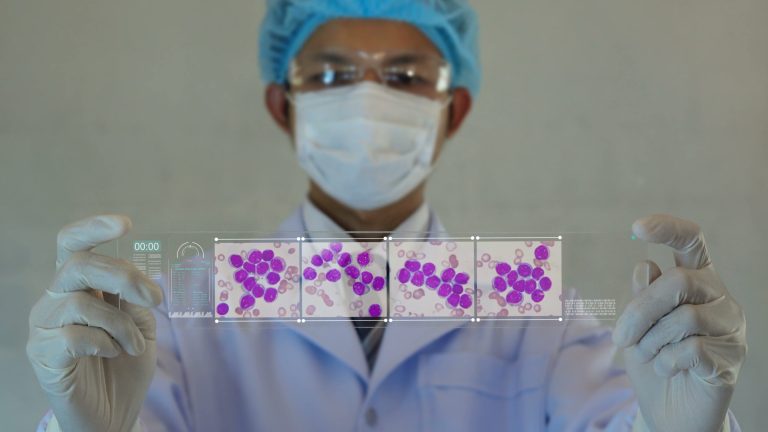 Diversitatea celulelor stem ale leucemiei determină rezistența la tratament în AML