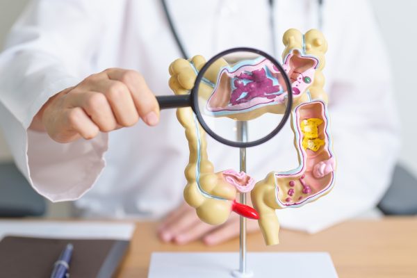 Mecanismele prin care Tumorile Colorectale Evită Inhibitorii KRAS Identificate