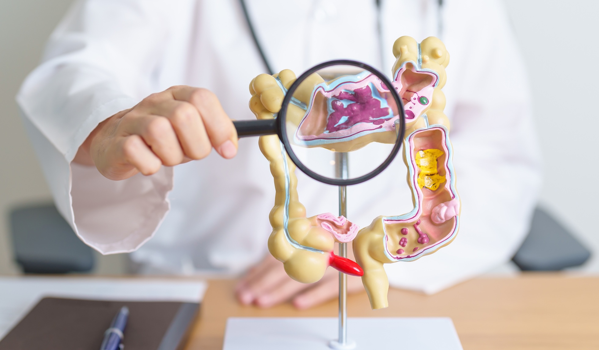 Mecanismele prin care Tumorile Colorectale Evită Inhibitorii KRAS Identificate