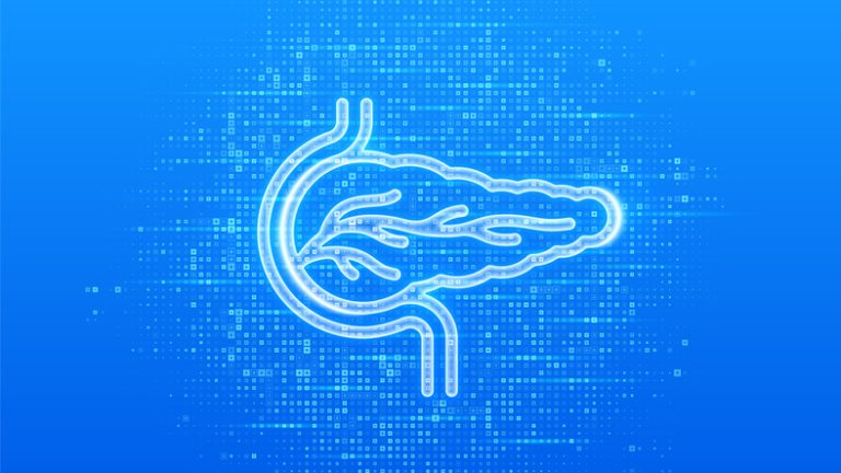 Inteligența Artificială REDMOD de la Mayo Clinic își dublează Sensibilitatea în Detectarea Timpurie a Cancerului Pancreatic