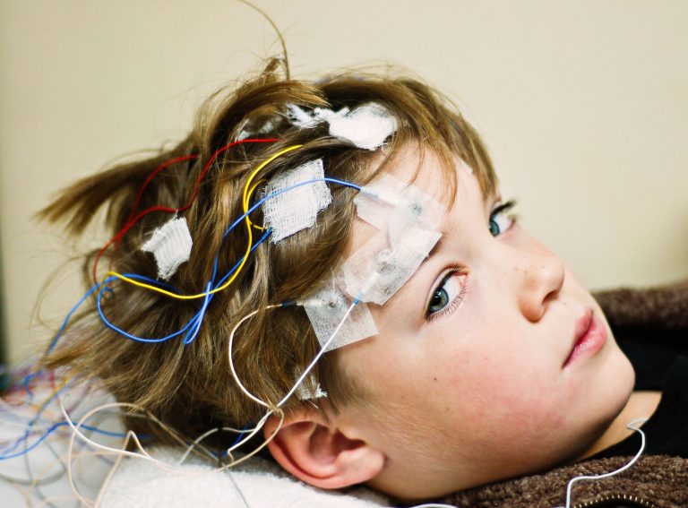 Screening pentru Autism propus pentru Copiii cu Epilepsie