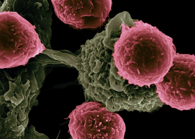 Terapia revoluționară împotriva cancerului ar putea transforma bolile autoimune