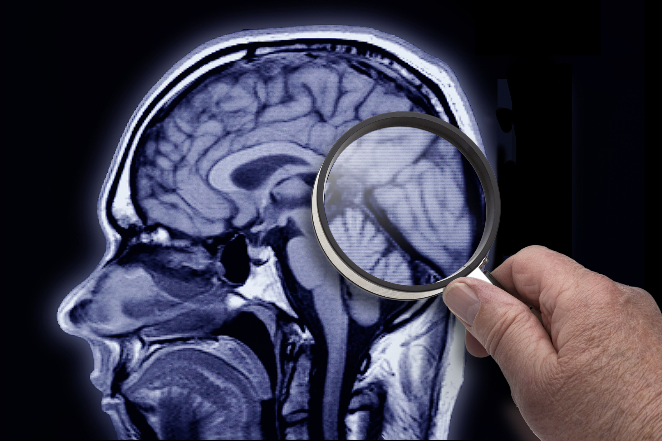 Cum Medicamentele Antigripale Ar Putea Preveni Declinul Cognitiv în Infecțiile Virale Cronice