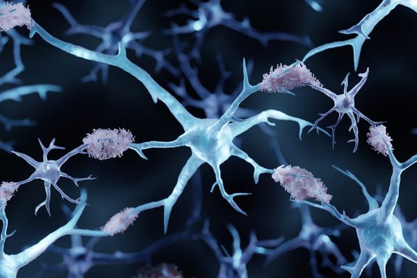 Un Medicament pe Bază de Cupru Elimină Depunerile de Proteine din Alzheimer la Șoareci