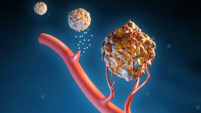 Cum celulele senescente favorizează creșterea tumorilor canceroase