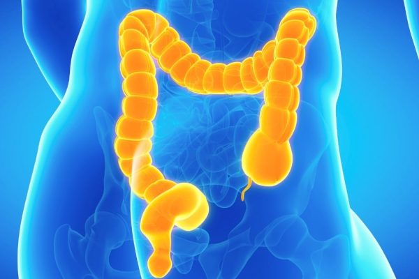 Cum poate deveni constipația periculoasă din cauza unei condiții rare a intestinului
