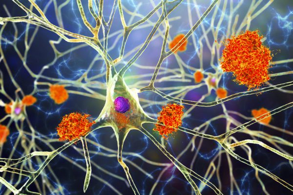 Descoperit OLE ca o posibilă țintă terapeutică pentru Alzheimer care vizează microglia
