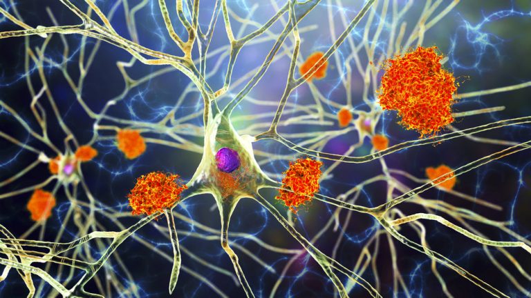 Descoperit OLE ca o posibilă țintă terapeutică pentru Alzheimer care vizează microglia