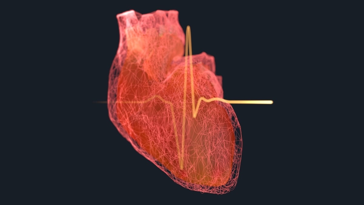 Studiu Major Care Leagă 99% din Atacurile de Cord și Accidentele Vasculare Cerebrale de 4 Factori de Risc