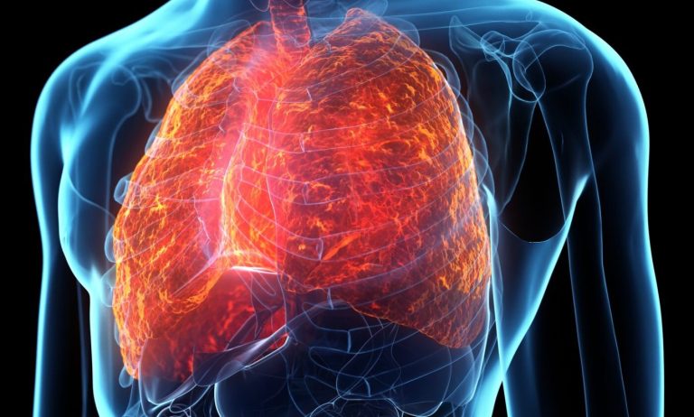 O nouă tehnică de imagistică poate diferenția inflamația pulmonară de fibroză