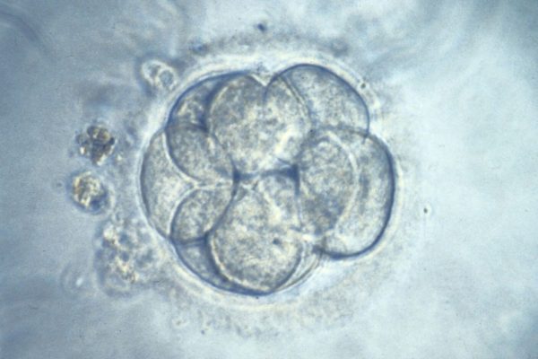 Dezbaterile privind modificarea precisă a genelor în embrioni umani timpurii reînvie discuția despre „bebelușii designer”