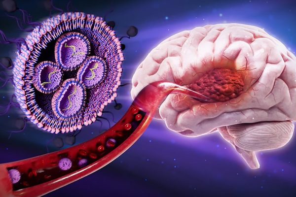 Nanoparticule acoperite cu zahăr reduc tumorile cerebrale letale la șoareci