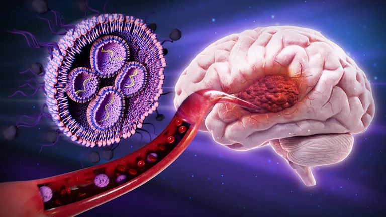 Nanoparticule acoperite cu zahăr reduc tumorile cerebrale letale la șoareci
