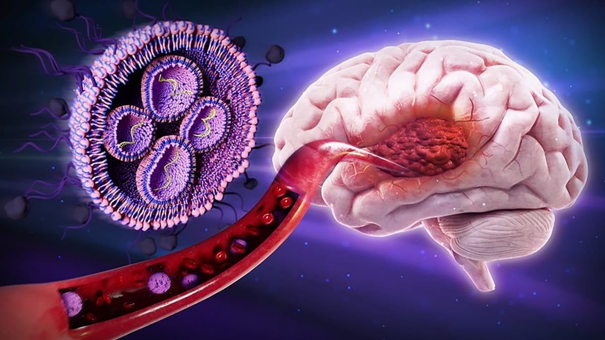 Nanoparticule acoperite cu zahăr reduc tumorile cerebrale letale la șoareci