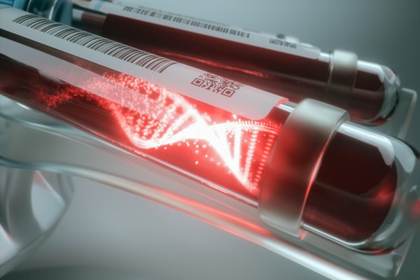 Testul ctDNA extrem de sensibil îmbunătățește detectarea cancerului pancreatic rezidual