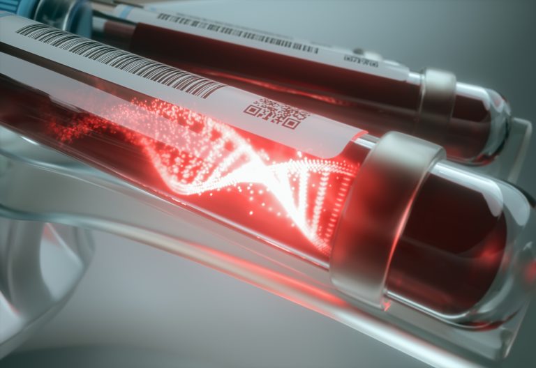 Testul ctDNA extrem de sensibil îmbunătățește detectarea cancerului pancreatic rezidual