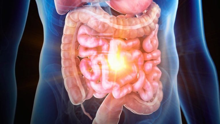 Cum a fost recreată boala inflamatorie intestinală pe un cip, iar oamenii de știință ar putea în sfârșit descoperi cauza sa