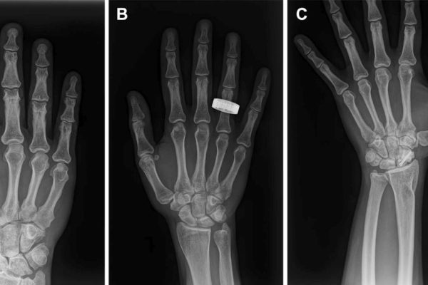Astronauții au Realizat Primele Radiografii Umane în Spațiul Cosmic