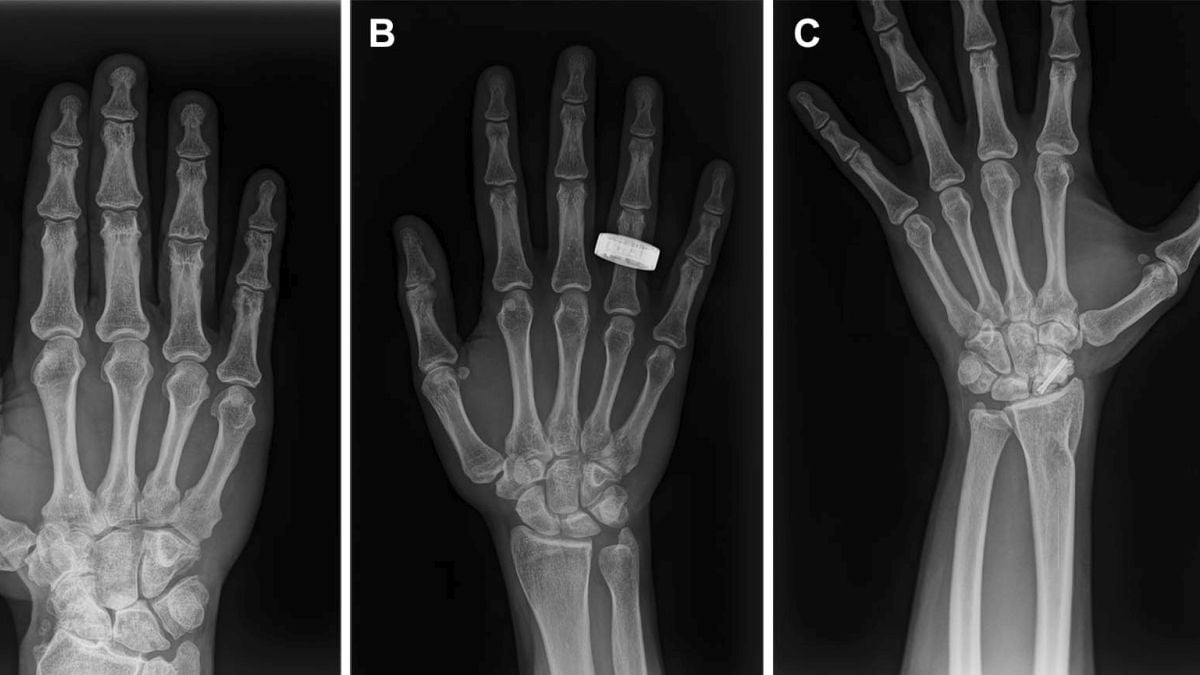 Astronauții au Realizat Primele Radiografii Umane în Spațiul Cosmic
