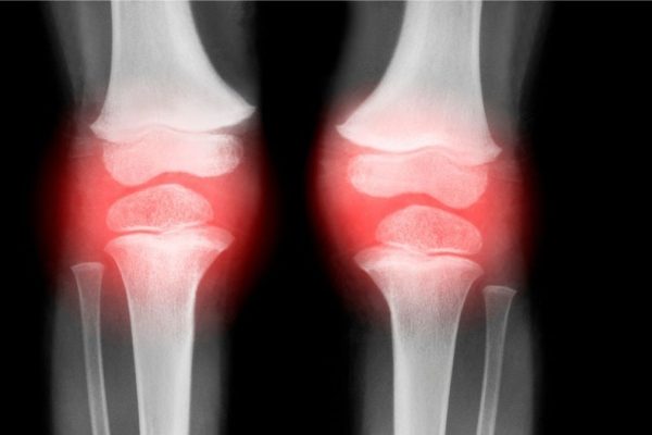 Injectare unică revine osteoartritei la animale în doar 4 săptămâni