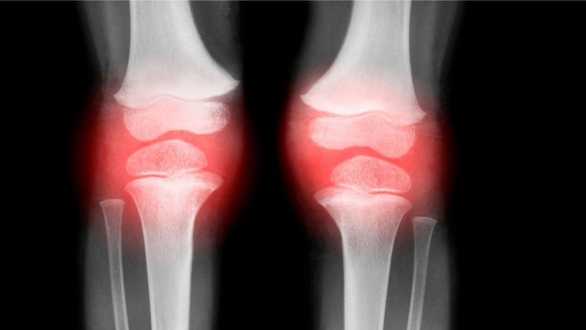 Injectare unică revine osteoartritei la animale în doar 4 săptămâni